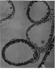 Microscopic images of melanized fungal cells:. From Dadachova et al. 2007