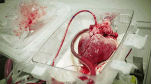 The Organ Care System pumps blood and nutrients through a human heart before transplant surgery. Credit: Josh Kurz
