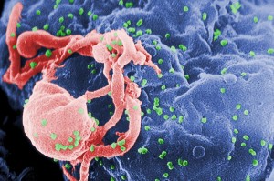Scanning electron micrograph of HIV-1 (in green) budding from cultured lymphocyte. Multiple round bumps on cell surface represent sites of assembly and budding of virions. Photo Credit: Centers for Disease Control (CDC)