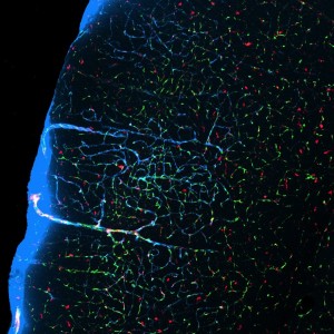 When mice sleep, ﬂuid-filled channels (pale blue) between neurons expand and flush out waste. (Photo credit: Xie et al. 2013, Science)