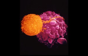  Viral-based cancer therapy: T cells (orange) are recruited to attack malignant cells (purple). (Photo credit: Dr. Andrejs Liepins/SPL)