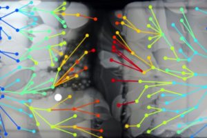 Depiction of bacteria evolution to antibiotics (Photo Credit: Michael Baym)
